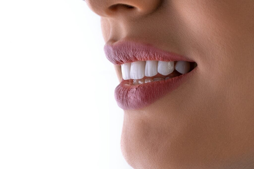 Close-up side profile of a woman smiling with perfectly aligned white dental veneers against a white background